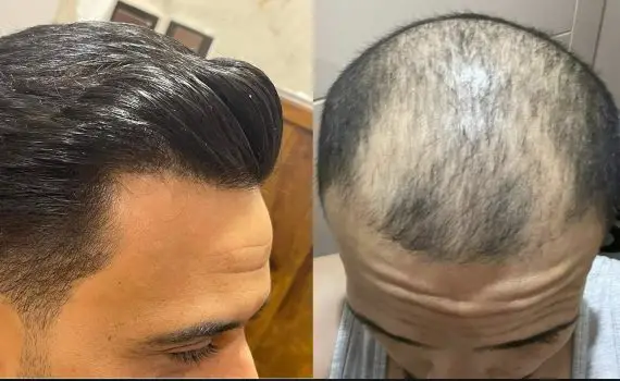 Rough black lines textured background