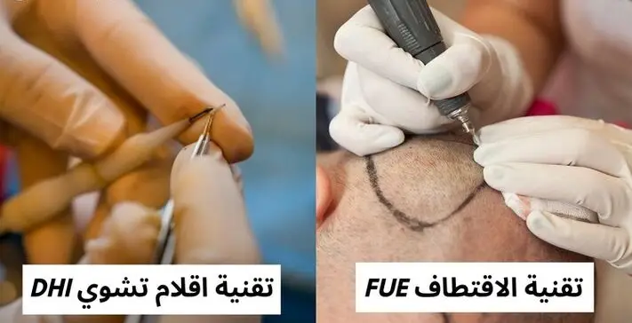 الفرق بين تقنية الاقتطاف و تقنية اقلام تشوي