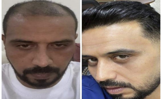 Rough black lines textured background