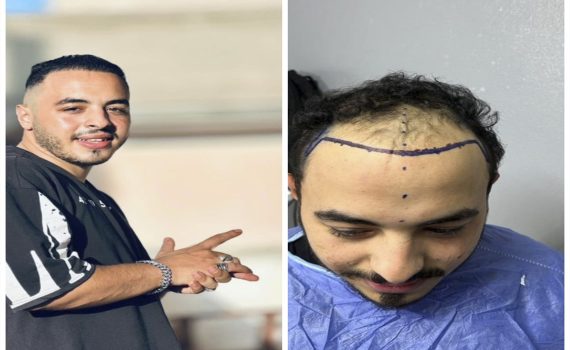 Rough black lines textured background