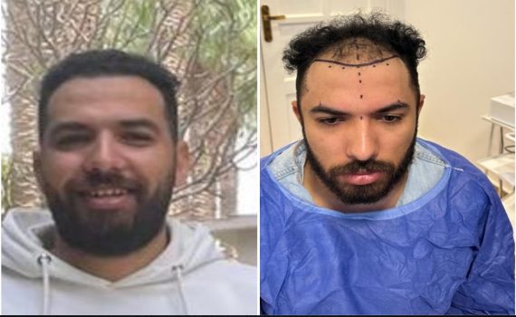 Rough black lines textured background