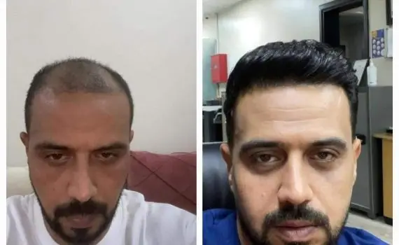 WhatsApp Image 2024-05-06 at 12.51.26 PM