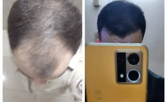 WhatsApp Image 2024-05-06 at 5.37.19 PM