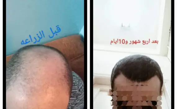 WhatsApp Image 2024-05-06 at 5.38.11 PM