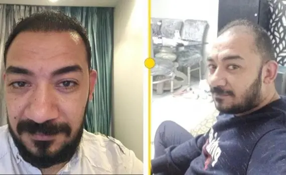 Rough black lines textured